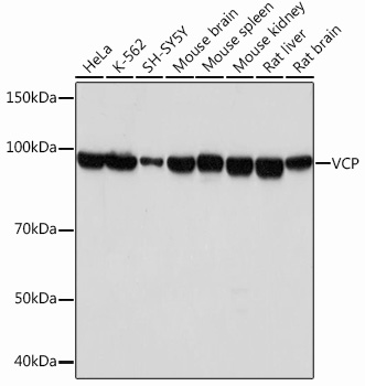 VCP Rabbit mAb