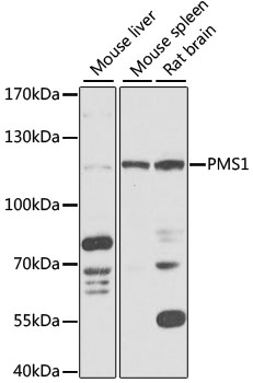 PMS1 Rabbit pAb