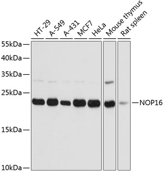 NOP16 Rabbit pAb