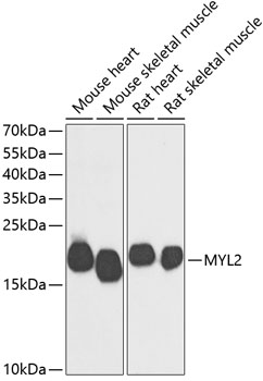 MYL2 Rabbit pAb