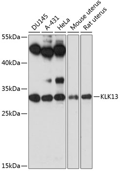 KLK13 Rabbit pAb