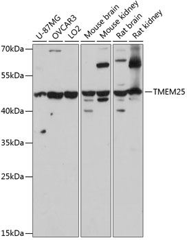 TMEM25 Rabbit pAb
