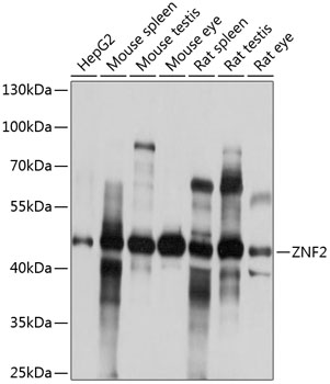 ZNF2 Rabbit pAb