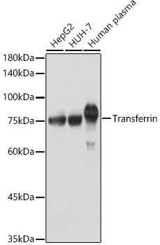 Transferrin Rabbit pAb