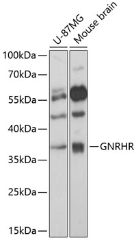 GNRHR Rabbit pAb