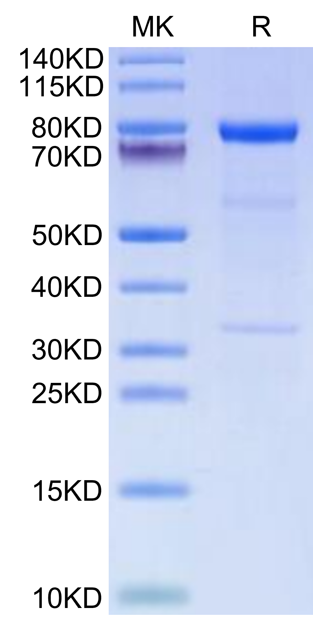 Human Complement Component C1s Protein (LTP10012)