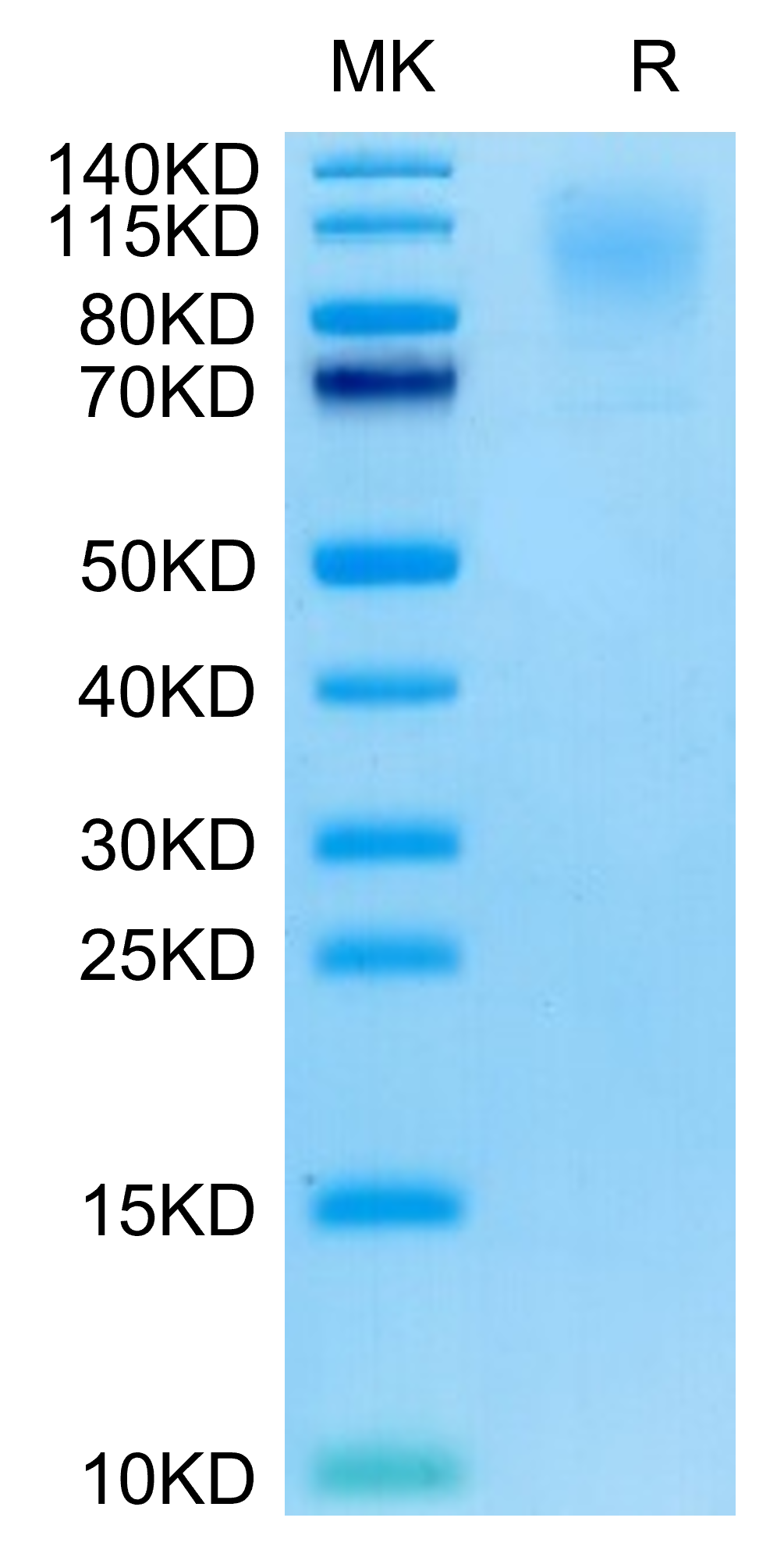Cynomolgus CD43 Protein (LTP10024)