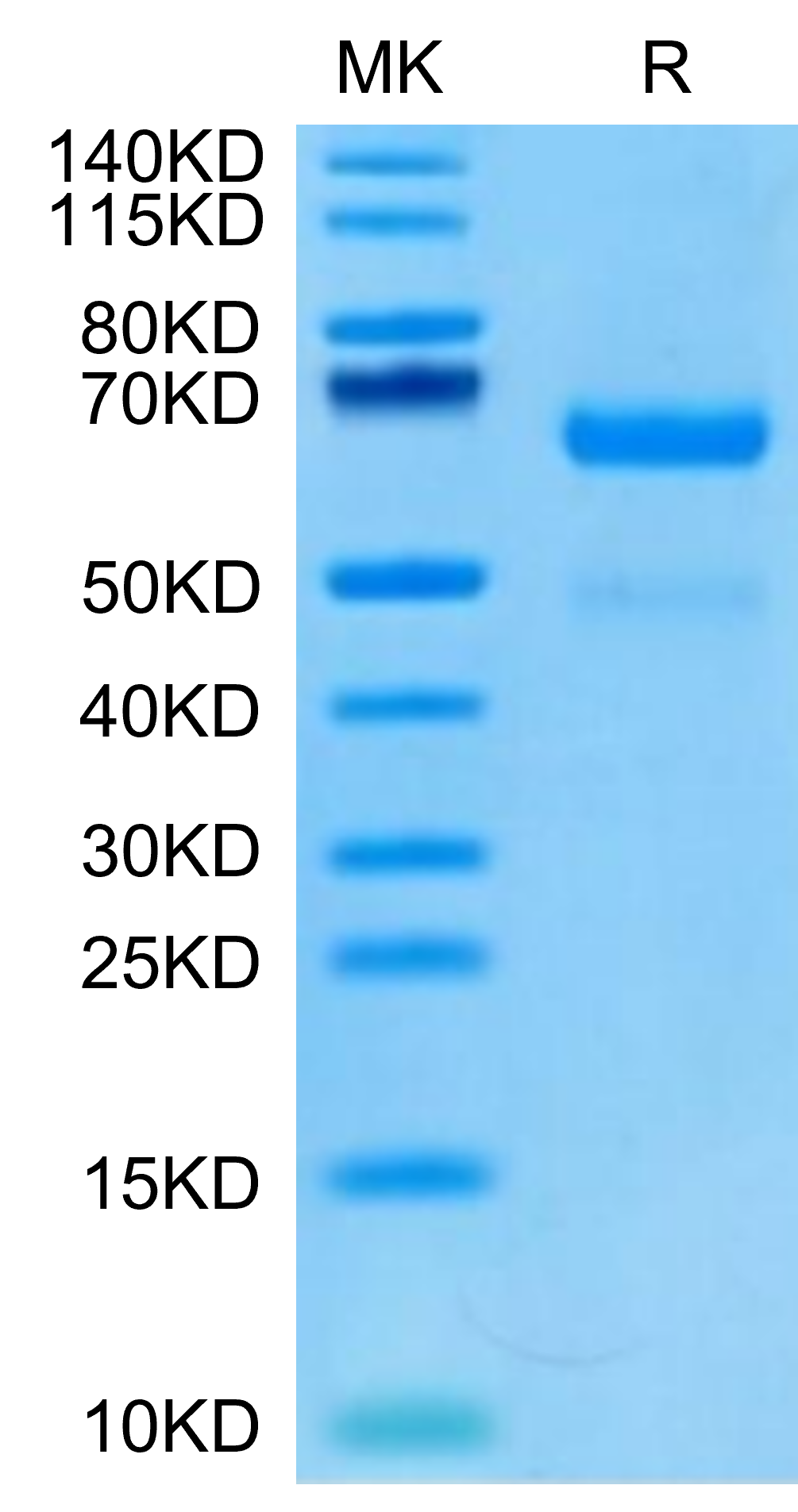 Human LRP10 Protein (LTP10039)