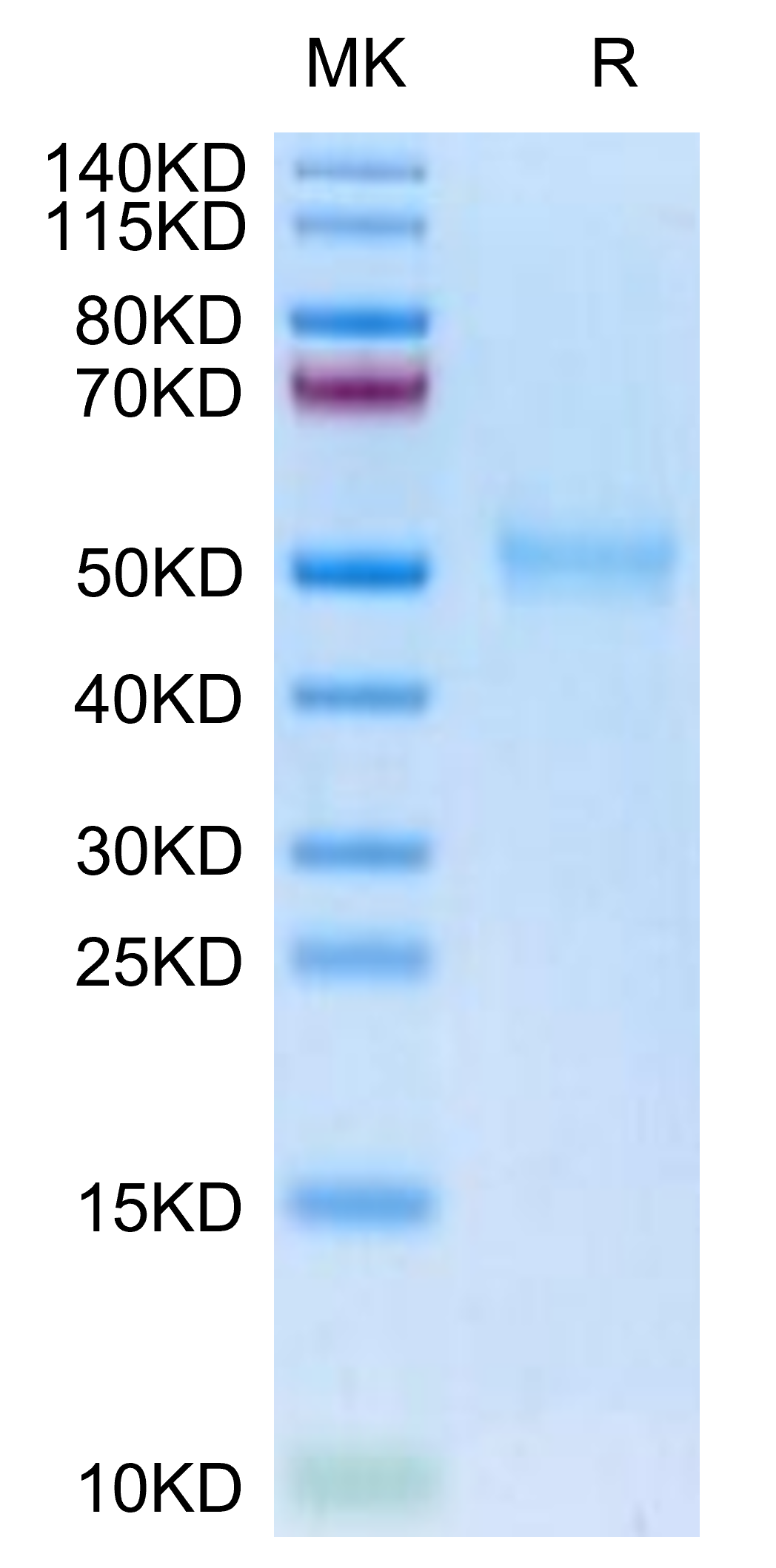 Biotinylated Human TGFBR1 Protein (LTP10141)