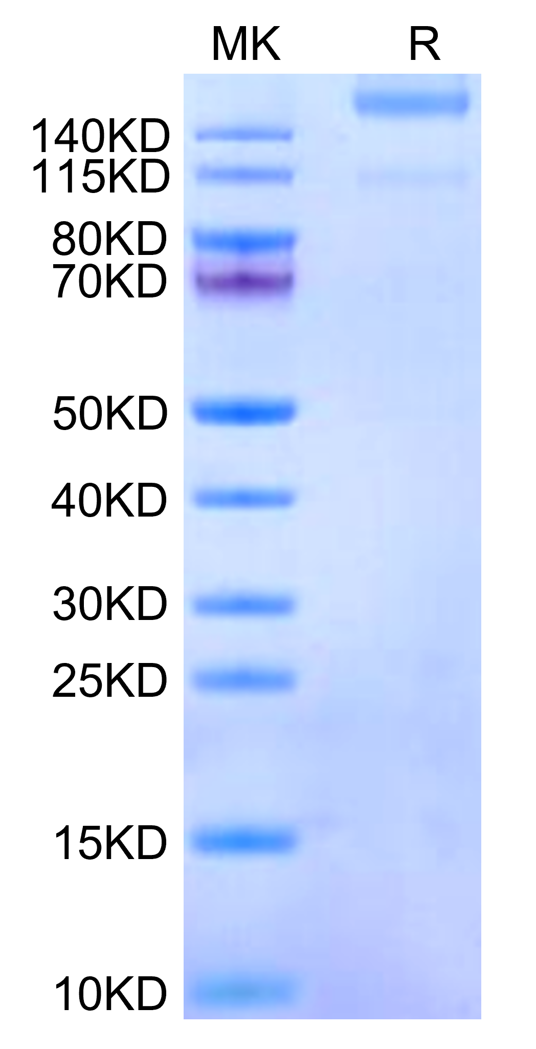 Human Integrin alpha A1 beta 1 (ITGA1&ITGB1) Heterodimer Protein (LTP10165)