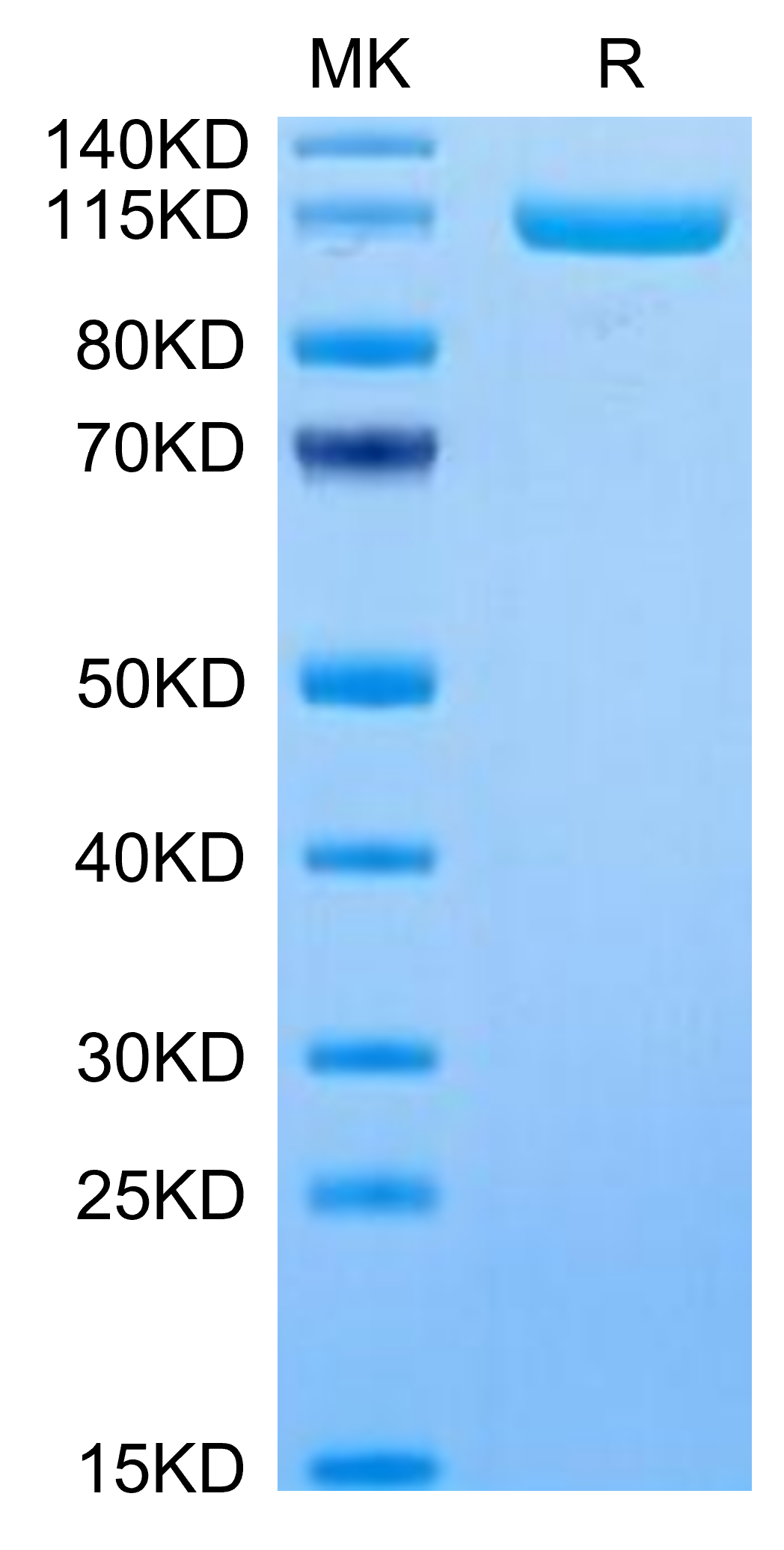 Human ENPP-3 Protein (LTP10192)