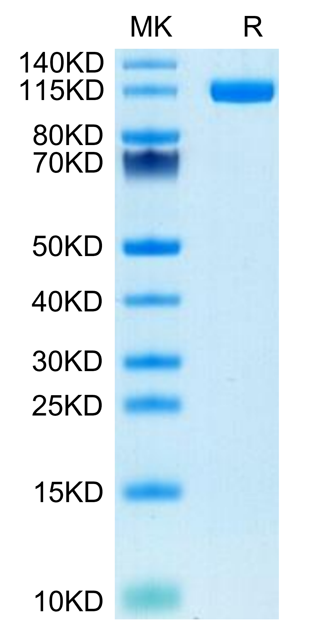 Human ENPP-1 Protein (LTP10228)