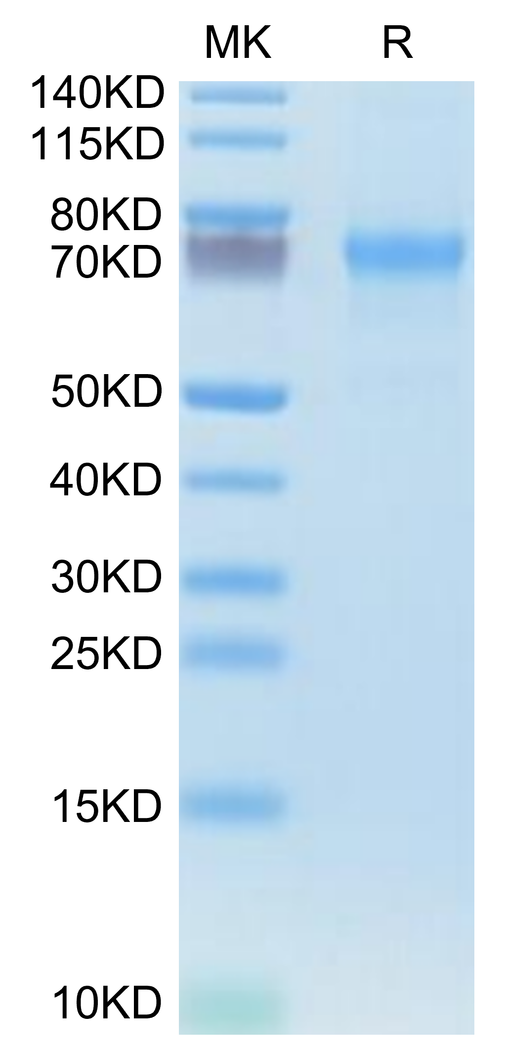 Human CXCL16 Protein (LTP10318)