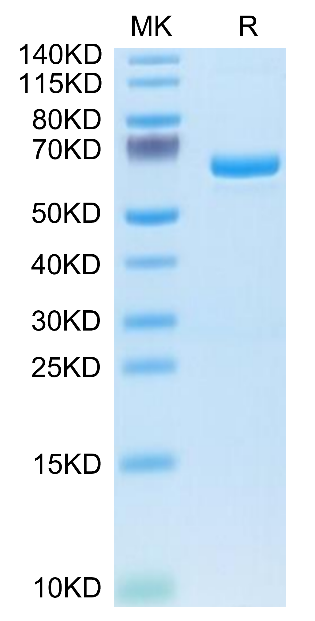 Human APOE4/Apolipoprotein E Protein (LTP10346)