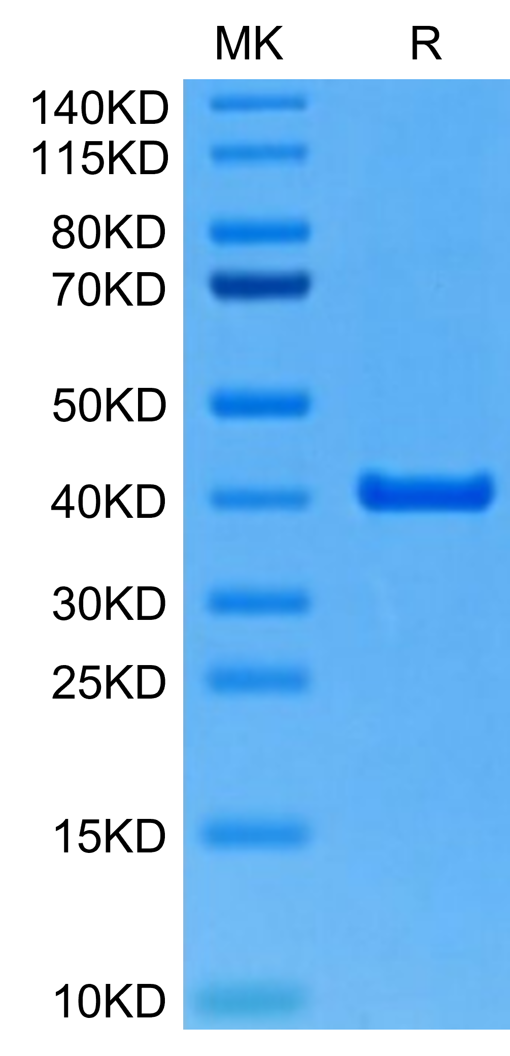 Mouse ANXA2 Protein (LTP10363)