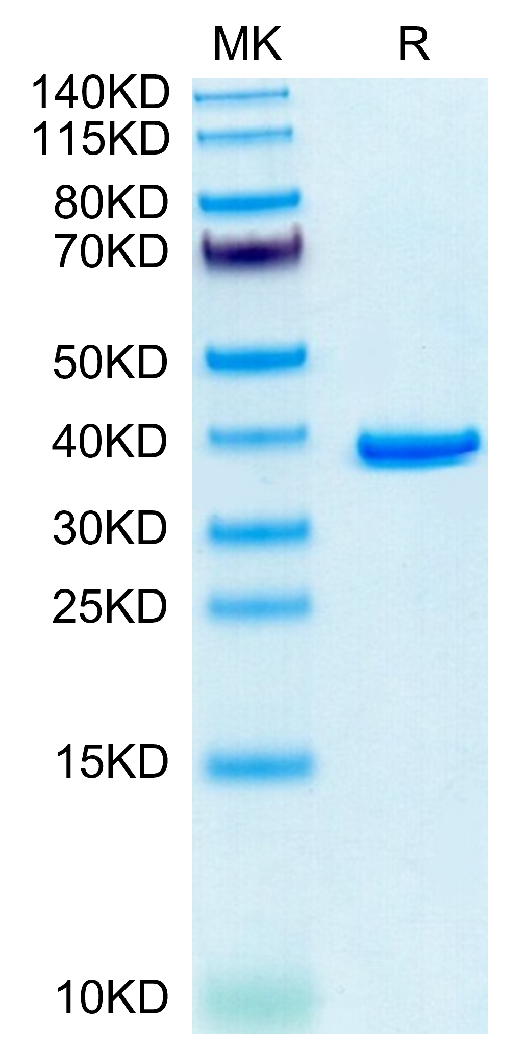 Human ANXA2 Protein (LTP10364)