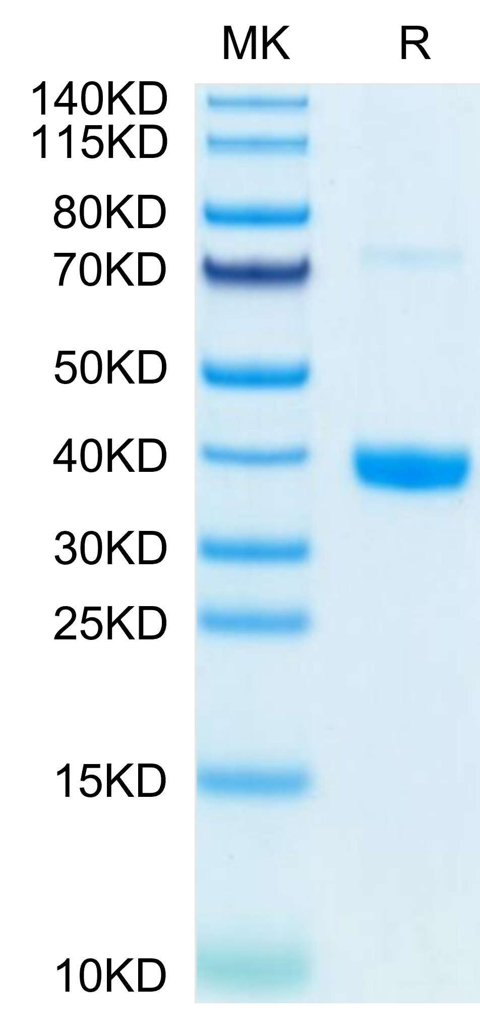 Mouse MFAP4 Protein (LTP10479)