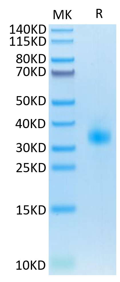 Mouse SOST/Sclerostin Protein (LTP10489)