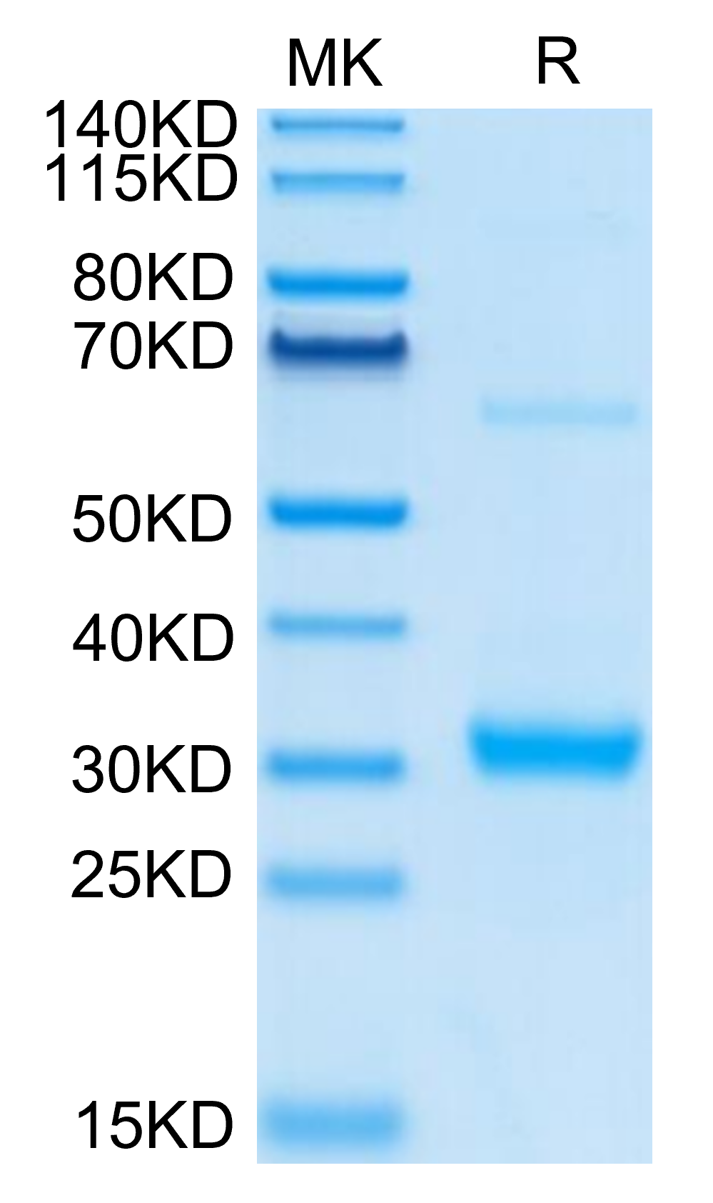 Human CLEC10A Protein (LTP10568)