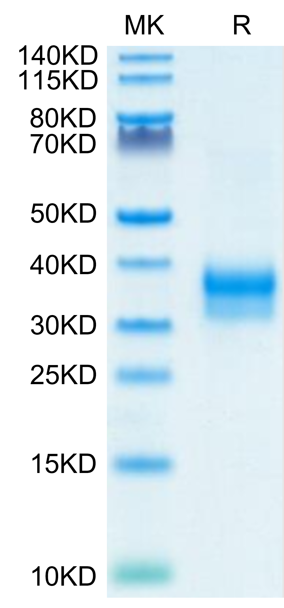 Mouse Siglec-15/CD33L3 Protein (LTP10811)
